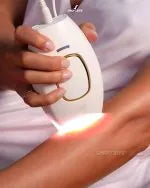 Depiladora láser IPL