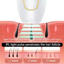 Depiladora láser IPL